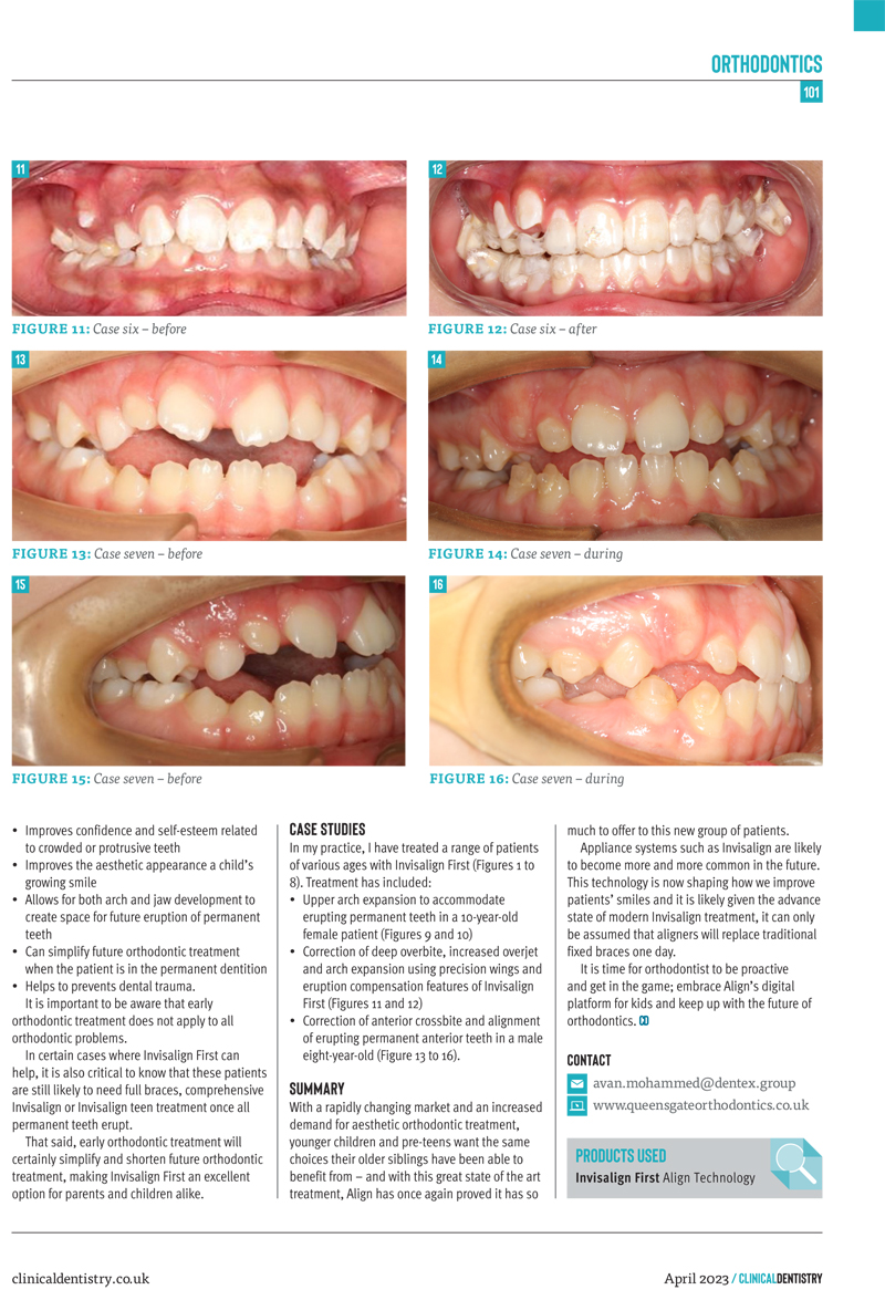 Dr Avan Mohammed discusses